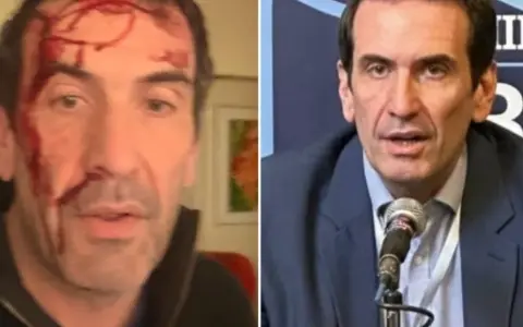 Pablo Cervi.