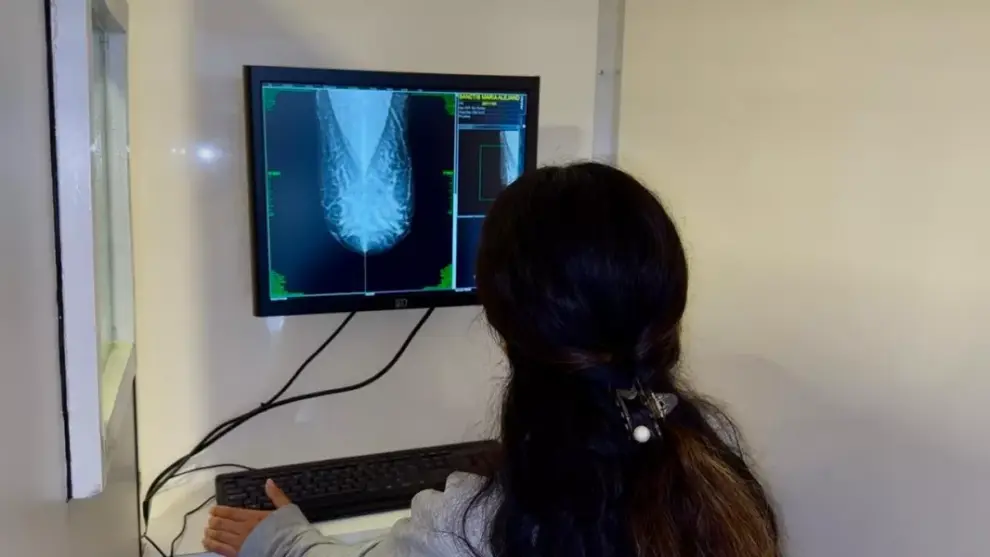 Camión de mamografía