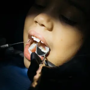 Salta: chequeos gratuitos para prevenir el cáncer bucal