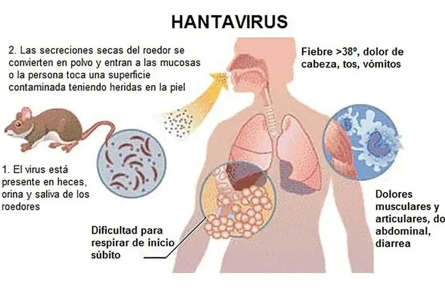 Hantavirus