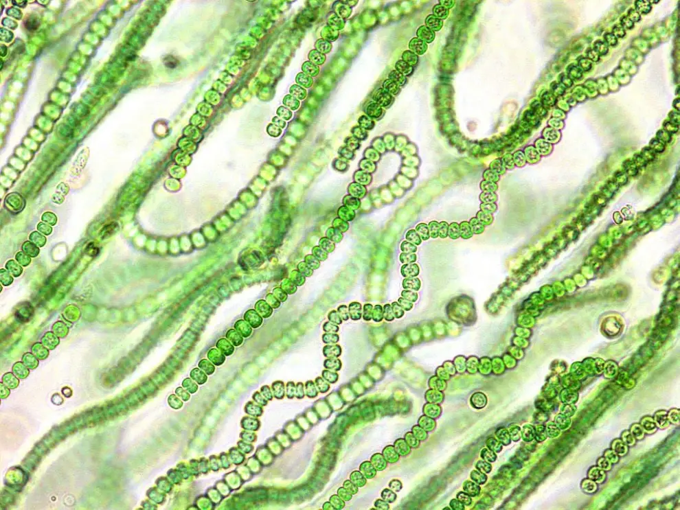 cianobacterias