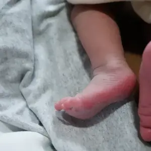 Bebé internada en grave estado por presunto maltrato en Salta: Detuvieron e imputaron a los padres