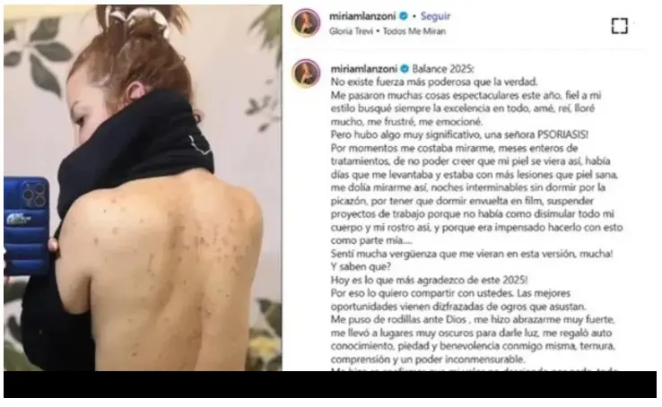 la actriz contó que atravesó largos meses de tratamientos y momentos de profunda angustia