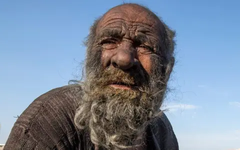 Este hombre vivió más de 60 años sin bañarse.