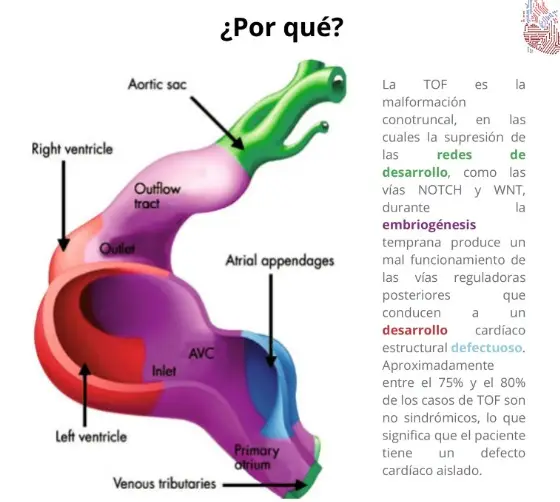 Tetralogía de Fallot: la condición cardíaca que atraviesa Mateo