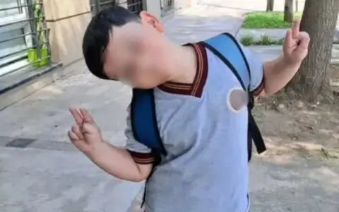 El niño tiene 8 años y, al momento del choque, vajaba en un UTV a upa de su padre