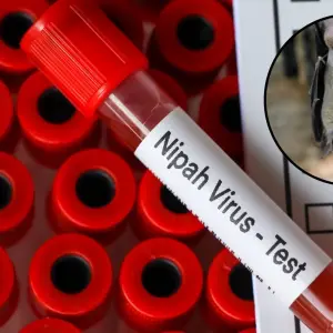 Tras la detección de casos de virus Nipah la OMS advierte por una segunda pandemia mundial