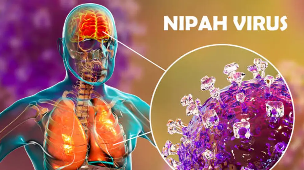 Alerta por el nuevo virus Nipah