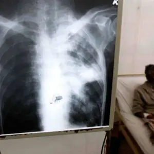 Servicio Penitenciario: Un hombre fue hallado sin vida en una celda de la Alcaidía General en medio de un brote de tuberculosis