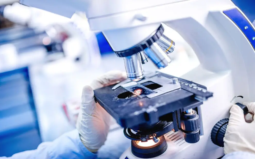 El diagnóstico del cáncer de ovarios se hace con una biopsia