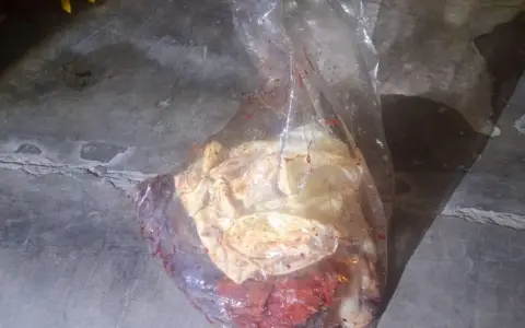 Desechos Patógenos