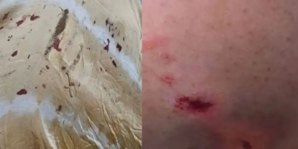 Mordedura de perro a Andrea Taboada