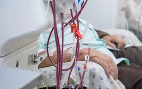 La diálisis es un tratamiento extenuante y agotador para los pacientes.
