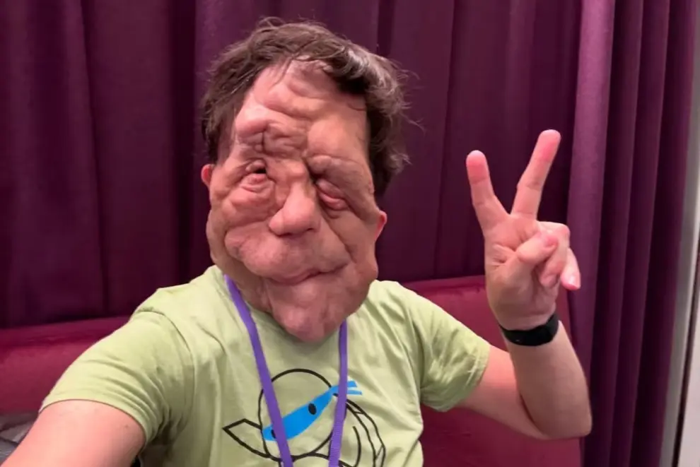 Adam Pearson - actor