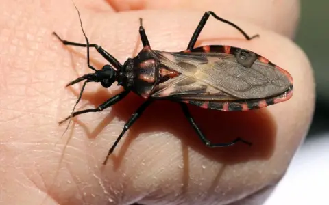 Mal de Chagas