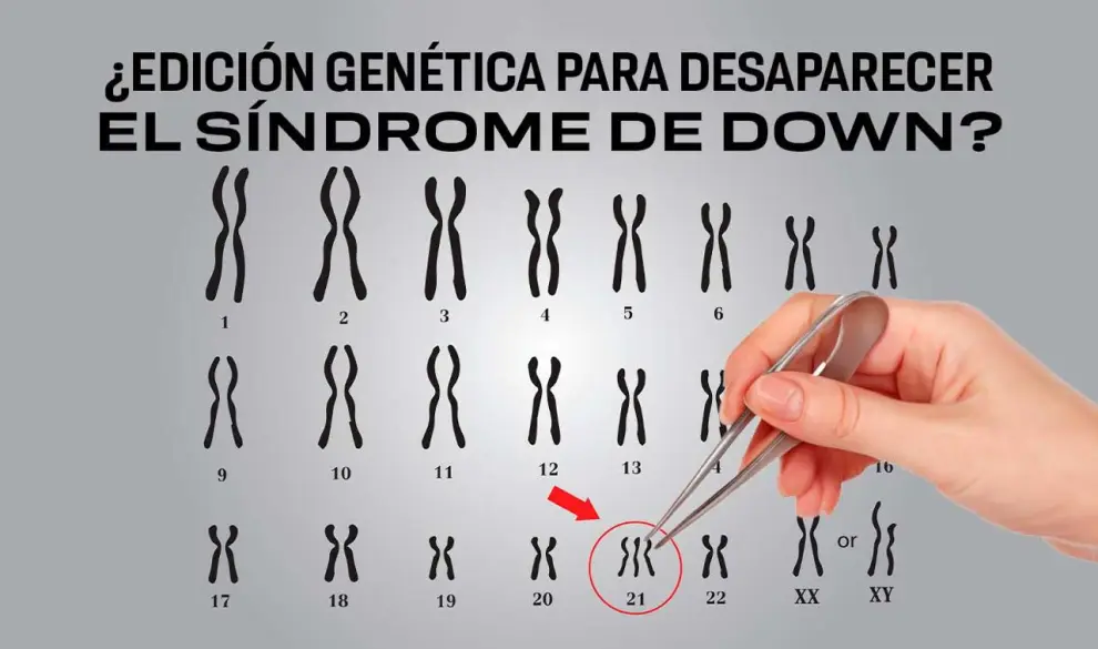 Síndrome de Down