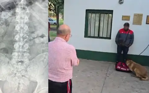 Bolivianos con cocaína en sus estómagos