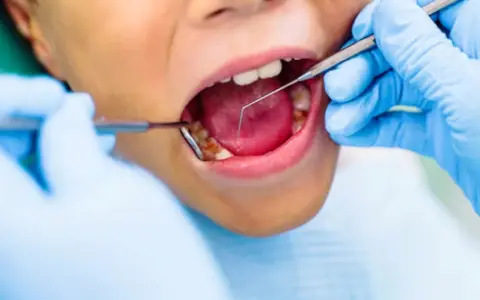 Una mala praxis odontológica dejó a un niño con serias secuelas.