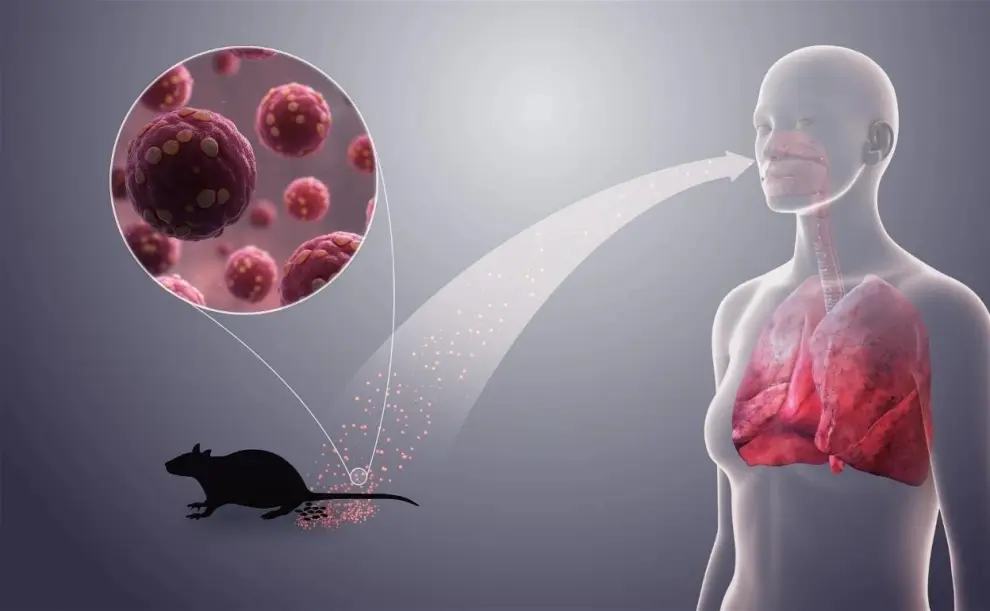 Los síntomas iniciales del hantavirus suelen confundirse con una gripe.