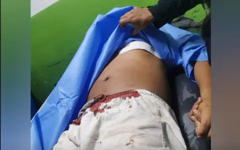 Franco Vargas se encuentra internado tras el ataque sufrido el domingo
