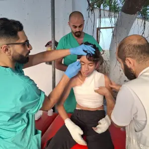 Máscaras impresas en 3D devuelven esperanza a niños con graves quemaduras en Gaza