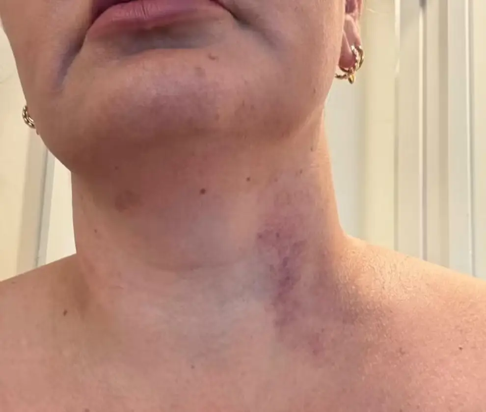 La mujer víctima del presunto abuso.