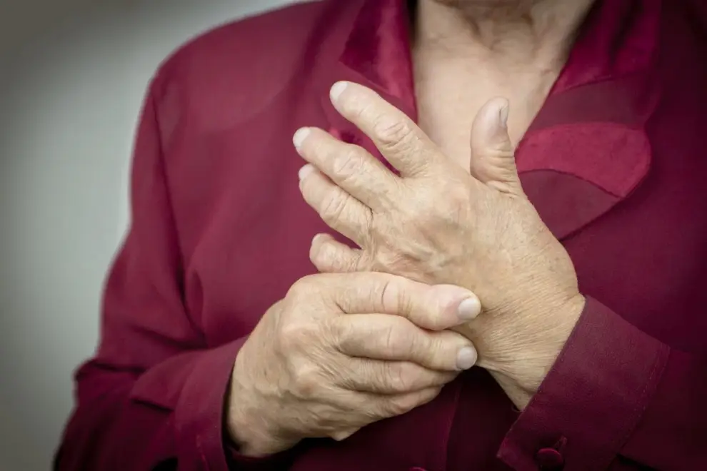 Esclerosis Sistémica es una enfermedad inflamatoria sistémica de carácter crónico.