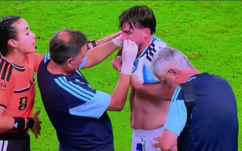 Nicolás Tagliafico, atendido por el cuerpo médico argentino tras sufrir una hemorragia nasal.