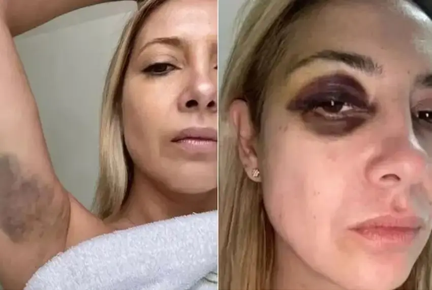 Las fotos que salieron a la opinión pública de Fabiola Yáñez.