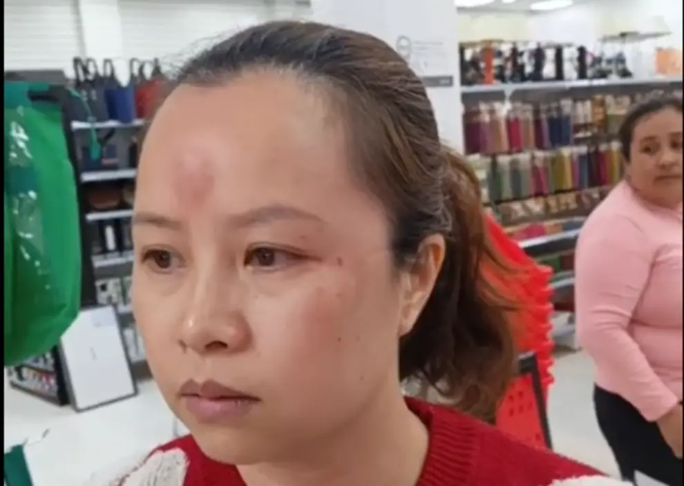 Así quedó la dueña de la regalería tras ser agredida