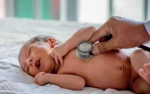 Preocupa la bronquilitis en Salta, con más de 4.000 casos en el primer semestre